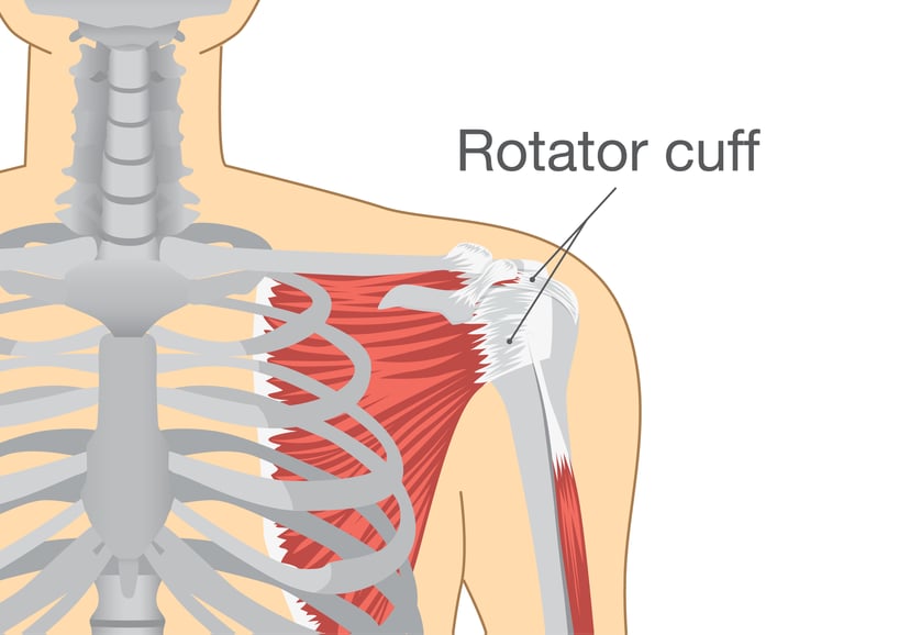 Common Sports Injuries Involving the Shoulder